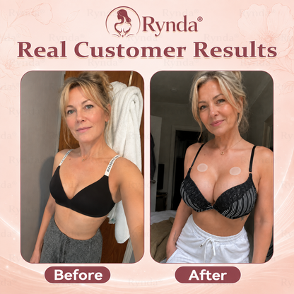 ⏰Rynda® 𝐁𝐫𝐞𝐚𝐬𝐭 𝐕𝐨𝐥𝐮𝐦𝐞 𝐁𝐨𝐨𝐬𝐭 & 𝐅𝐢𝐫𝐦 𝐌𝐢𝐜𝐫𝐨-𝐍𝐞𝐞𝐝𝐥𝐞 𝐏𝐚𝐭𝐜𝐡𝐞𝐬