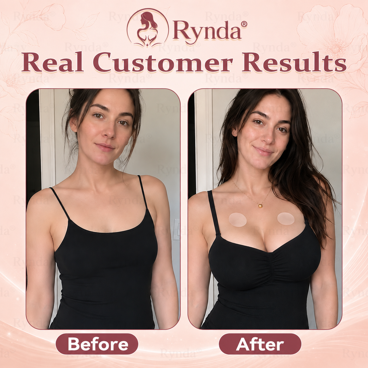 ⏰Rynda® 𝐁𝐫𝐞𝐚𝐬𝐭 𝐕𝐨𝐥𝐮𝐦𝐞 𝐁𝐨𝐨𝐬𝐭 & 𝐅𝐢𝐫𝐦 𝐌𝐢𝐜𝐫𝐨-𝐍𝐞𝐞𝐝𝐥𝐞 𝐏𝐚𝐭𝐜𝐡𝐞𝐬