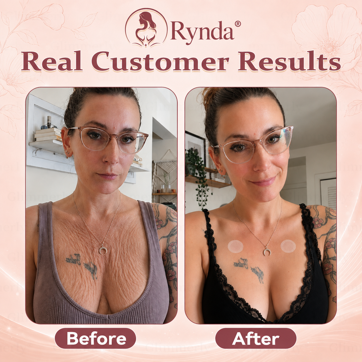 ⏰Rynda® 𝐁𝐫𝐞𝐚𝐬𝐭 𝐕𝐨𝐥𝐮𝐦𝐞 𝐁𝐨𝐨𝐬𝐭 & 𝐅𝐢𝐫𝐦 𝐌𝐢𝐜𝐫𝐨-𝐍𝐞𝐞𝐝𝐥𝐞 𝐏𝐚𝐭𝐜𝐡𝐞𝐬