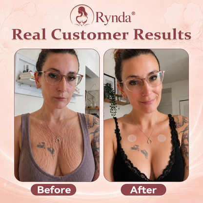 ⏰Rynda® 𝐁𝐫𝐞𝐚𝐬𝐭 𝐕𝐨𝐥𝐮𝐦𝐞 𝐁𝐨𝐨𝐬𝐭 & 𝐅𝐢𝐫𝐦 𝐌𝐢𝐜𝐫𝐨-𝐍𝐞𝐞𝐝𝐥𝐞 𝐏𝐚𝐭𝐜𝐡𝐞𝐬