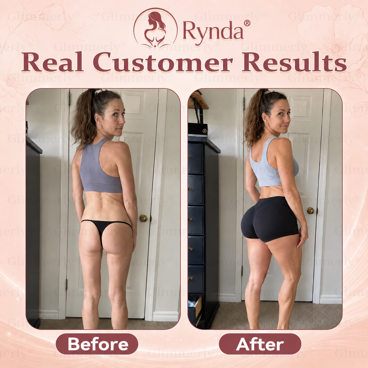 ⏰Rynda® 𝐁𝐫𝐞𝐚𝐬𝐭 𝐕𝐨𝐥𝐮𝐦𝐞 𝐁𝐨𝐨𝐬𝐭 & 𝐅𝐢𝐫𝐦 𝐌𝐢𝐜𝐫𝐨-𝐍𝐞𝐞𝐝𝐥𝐞 𝐏𝐚𝐭𝐜𝐡𝐞𝐬